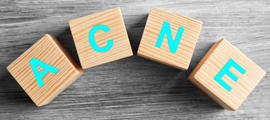 What is acne and how can I deal with it?